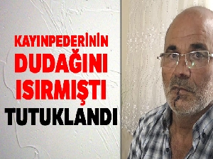 Kayınpederinin dudağını ısırarak parçalayan 'Hannibal' damat tutuklandı