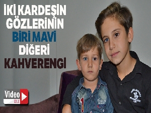 İki kardeşin gözlerinin biri mavi, diğeri kahverengi