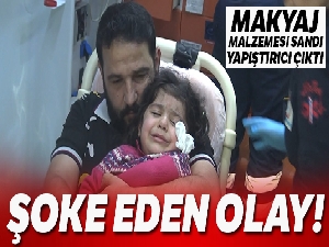 Makyaj malzemesi sandığı yapıştırıcıyla gözlerini yapıştırdı