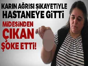 Karın ağrısı şikayetiyle hastaneye giden kadının midesinden çıkan şok etti