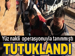 Yüz nakliyle tanınmıştı, adam öldürmeye teşebbüs suçundan tutuklandı