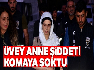 Üvey anne şiddeti komaya soktu