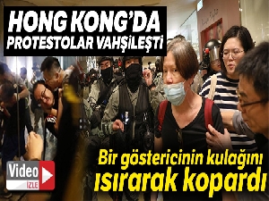 Bıçakla 6 kişiyi yaraladı, bir göstericinin ise kulağını ısırarak kopardı
