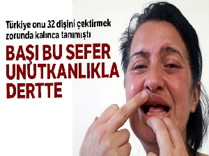 Beyaz diş hayaliyle 32 dişinden olan kadının başı bu sefer unutkanlıkla dertte