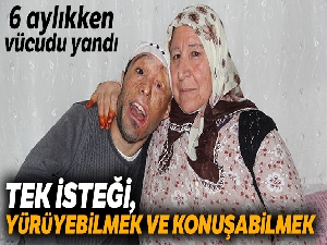 Vücudu yanan Mehmet Ali'nin dramı: Tek isteği yürüyebilmek ve konuşabilmek