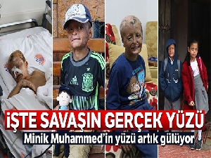 Savaş mağduru Muhammed amcasına kavuştu