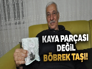 Kaya parçası değil böbrek taşı