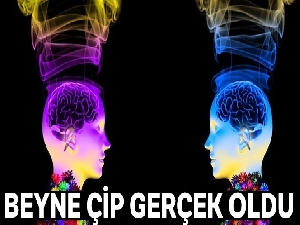 Beyne çip takıldı