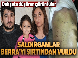 Silahlı saldırganlar küçük Berra'yı sırtından vurdu