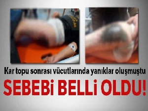 Afyonkarahisar'da öğrencilerin vücutlarındaki yanıkların sebebi belli oldu