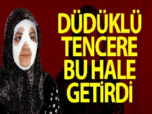 Bomba gibi patlayan düdüklü tencere genç kadına dehşeti yaşattı