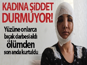 Kocası yüzünü bıçakla paramparça etti, ölümden kıl payı kurtuldu
