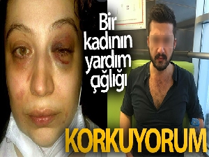 Eski eşi tarafından tehdit ve darp edilen kadın suç duyurusunda bulundu
