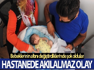 Yeni doğan bebeklerinin altını değiştirdiklerinde şok oldular