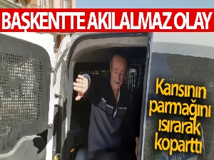 Koca karısının parmağını ısırarak koparttı