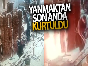 Çakmakla gaz kaçağını kontrol ederken yanıyordu
