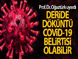 Prof. Dr. Oğuztürk uyardı: 'Deride döküntü Covid-19 belirtisi olabilir'