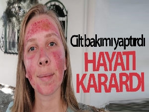Cilt bakımı yaptıran kadının hayatı karardı