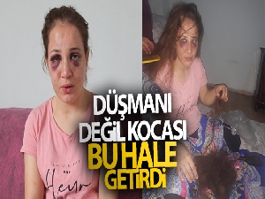 3 çocuk annesi Özlem'i düşmanı değil kocası bu hale getirdi