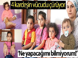 Bu kardeşlerin kol ve ayakları çürüyor