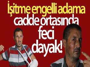 İşitme engelli adama cadde ortasında feci dayak
