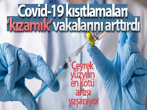 Covid-19 kısıtlamaları 'kızamık' vakalarını arttırdı