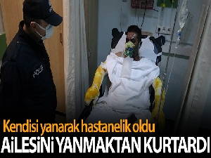 Yangında ailesini yanmaktan kurtardı, kendisi yanarak hastanelik oldu