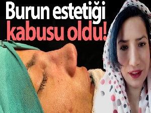 Burun estetiği kabusu oldu
