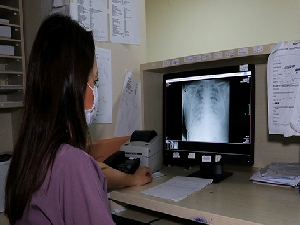 Koronalı hastaların akciğer röntgenleri korkuttu