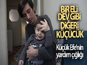Bir eli dev gibi, diğeri küçücük