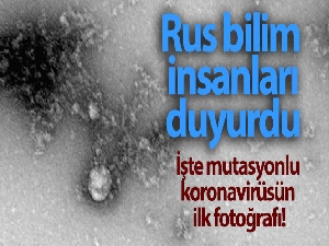 Rusya'da, korona virüs mutasyonunun fotoğrafı çekildi