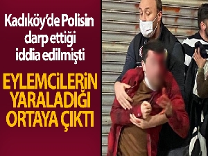 Polisin darp ettiği iddia edilen vatandaş kendisini eylemcilerin yaraladığını söyledi