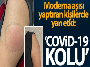 ABD'de Moderna aşısı yaptıran kişilerde yan etki: 'Covid-19 kolu'