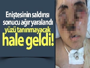 Eniştesinin saldırısı sonucu ağır yaralandı, yüzü tanınmayacak hale geldi