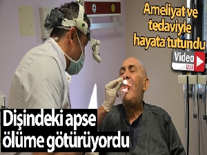 Dişindeki apse ölümüne yol açıyordu: Ameliyat ve 2 aylık tedavi sonucu hayata tutundu