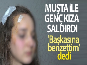 Genç kız, tanımadığı kişi tarafından sokak ortasında 'Muşta' ile darp edildi
