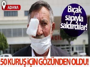 50 kuruşluk tuvalet parası için gözünden oldu!