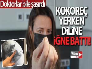 Kokoreç yerken diline iğne batan kadın doktorları da şaşırttı
