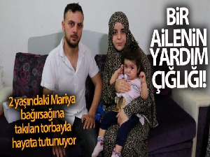 2 yaşındaki Mariya bağırsağına takılan torbayla hayata tutunuyor