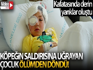 Köpeğin saldırısına uğrayan çocuk ölümden döndü