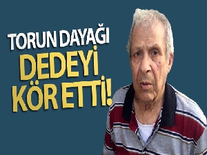 Torun dayağı dedeyi kör etti
