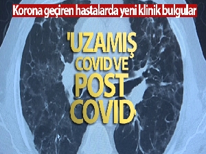 Korona virüs geçiren hastalarda yeni klinik bulgular: 'Uzamış Covid ve post Covid'