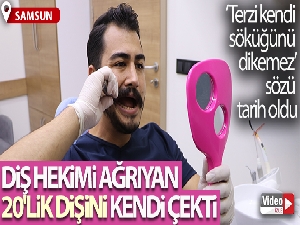 Diş hekimi ağrıyan 20'lik dişini kendi çekti