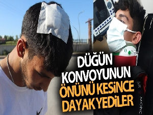 Düğün konvoyunun önünü kesince hastanelik oldular