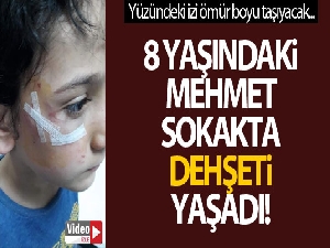 Sokak köpeği 8 yaşındaki Mehmet'in yanağını koparıyordu!
