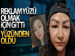 Reklam yüzü olmak için gitti, yüzünden oldu