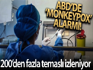 ABD'de Monkeypox virüsü alarmı: 200'den fazla temaslı izleniyor