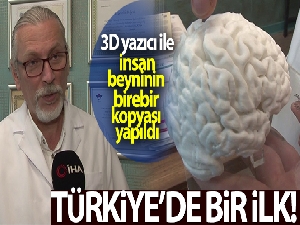 Türkiye'de bir ilk: 3D yazıcı ile insan beyninin birebir kopyası yapıldı