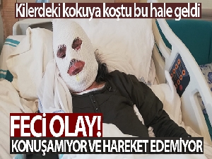 70 yaşındaki kadın tüp patlaması sonucu feci şekilde yandı