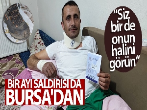 Bir ayı saldırısı da Bursa'dan